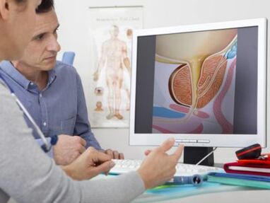 The urologist consults the patient about prostatitis and its treatment.